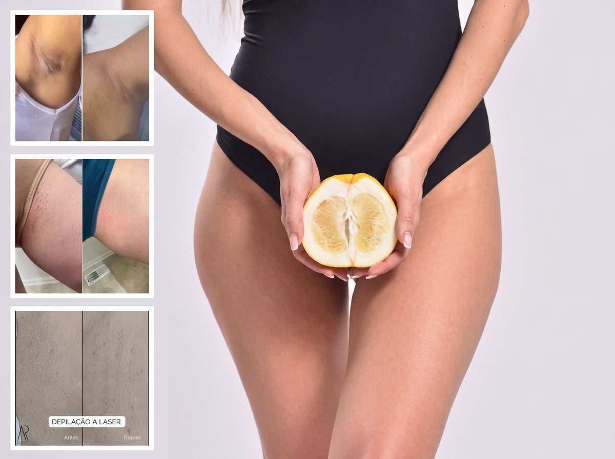 Depiladora Láser IPL Kit Completo — Eliminación de Vello en Casa